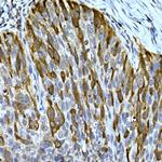 RRM2 Antibody in Immunohistochemistry (Paraffin) (IHC (P))