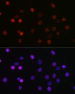 SETD8 Antibody in Immunocytochemistry (ICC/IF)