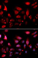 RACGAP1 Antibody in Immunocytochemistry (ICC/IF)