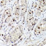 RACGAP1 Antibody in Immunohistochemistry (Paraffin) (IHC (P))