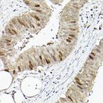 RACGAP1 Antibody in Immunohistochemistry (Paraffin) (IHC (P))