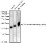 ABAT Antibody in Western Blot (WB)