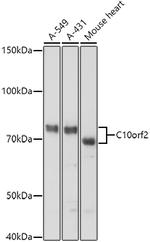 PEO1 Antibody in Western Blot (WB)