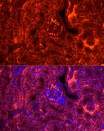 FABP3 Antibody in Immunocytochemistry (ICC/IF)