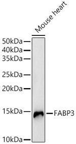 FABP3 Antibody in Western Blot (WB)