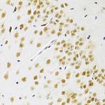 BAF57 Antibody in Immunohistochemistry (Paraffin) (IHC (P))