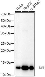 DBI Antibody in Western Blot (WB)