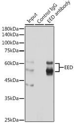 EED Antibody in Immunoprecipitation (IP)