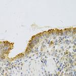 EBP1 Antibody in Immunohistochemistry (Paraffin) (IHC (P))