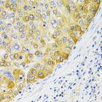 EBP1 Antibody in Immunohistochemistry (Paraffin) (IHC (P))