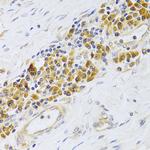 EBP1 Antibody in Immunohistochemistry (Paraffin) (IHC (P))