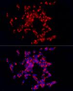 CARTPT Antibody in Immunocytochemistry (ICC/IF)