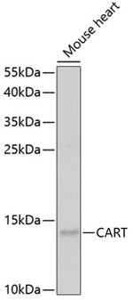 CARTPT Antibody in Western Blot (WB)