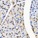 Cullin 4B Antibody in Immunohistochemistry (Paraffin) (IHC (P))