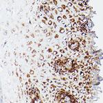 DLD Antibody in Immunohistochemistry (Paraffin) (IHC (P))