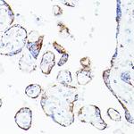 DLD Antibody in Immunohistochemistry (Paraffin) (IHC (P))