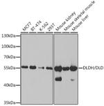 DLD Antibody in Western Blot (WB)