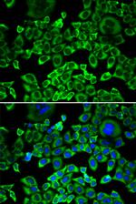 eIF4B Antibody in Immunocytochemistry (ICC/IF)