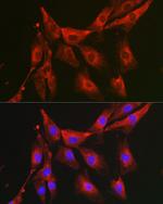 FBP1 Antibody in Immunocytochemistry (ICC/IF)