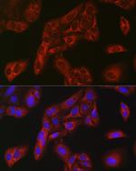 FBP1 Antibody in Immunocytochemistry (ICC/IF)