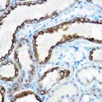 OAT Antibody in Immunohistochemistry (Paraffin) (IHC (P))