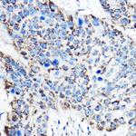 OAT Antibody in Immunohistochemistry (Paraffin) (IHC (P))