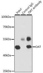 OAT Antibody in Immunoprecipitation (IP)