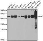 OAT Antibody in Western Blot (WB)