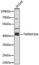 DR4 Antibody in Western Blot (WB)