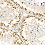 RAD51 Antibody in Immunohistochemistry (Paraffin) (IHC (P))