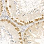 RAD51 Antibody in Immunohistochemistry (Paraffin) (IHC (P))