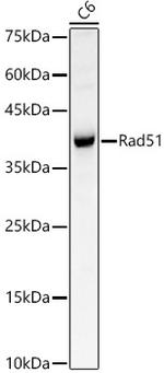 RAD51 Antibody in Western Blot (WB)