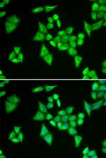 ADSL Antibody in Immunocytochemistry (ICC/IF)