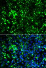 KV1.2 (KCNA2) Antibody in Immunocytochemistry (ICC/IF)