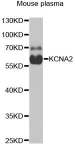 KV1.2 (KCNA2) Antibody in Western Blot (WB)