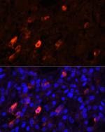 PENK Antibody in Immunocytochemistry (ICC/IF)