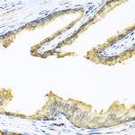 PENK Antibody in Immunohistochemistry (Paraffin) (IHC (P))