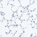 GAS41 Antibody in Immunohistochemistry (Paraffin) (IHC (P))