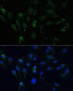 ZWINT Antibody in Immunocytochemistry (ICC/IF)