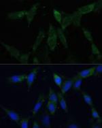 ZWINT Antibody in Immunocytochemistry (ICC/IF)