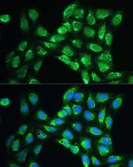 PRDX5 Antibody in Immunocytochemistry (ICC/IF)