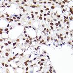 RCC1 Antibody in Immunohistochemistry (Paraffin) (IHC (P))