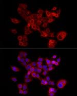 FABP5 Antibody in Immunocytochemistry (ICC/IF)