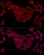 FABP5 Antibody in Immunocytochemistry (ICC/IF)