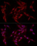 FABP5 Antibody in Immunocytochemistry (ICC/IF)