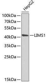 LIMS1 Antibody in Western Blot (WB)