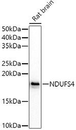 NDUFS4 Antibody in Western Blot (WB)