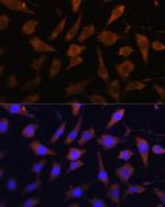 SERPINB9 Antibody in Immunocytochemistry (ICC/IF)