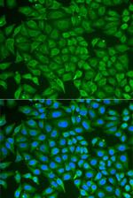 GCDFP-15 Antibody in Immunocytochemistry (ICC/IF)