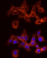 GPBB Antibody in Immunocytochemistry (ICC/IF)